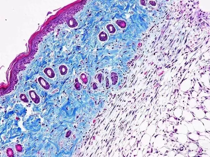 深入探秘Masson三色染色：解析实验原理、步骤与注意事项！_组织_脱水_研究