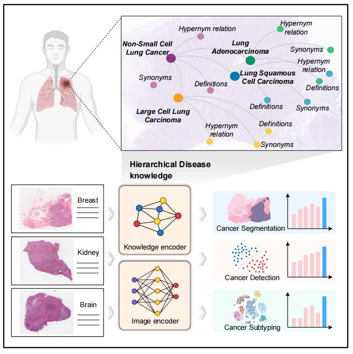 怎么买病理图文上海交大医工交叉团队在Nature与Cancer Cell连发两篇文章，均指向罕见病诊断难题_https://www.jmylbn.com_新闻资讯_第3张