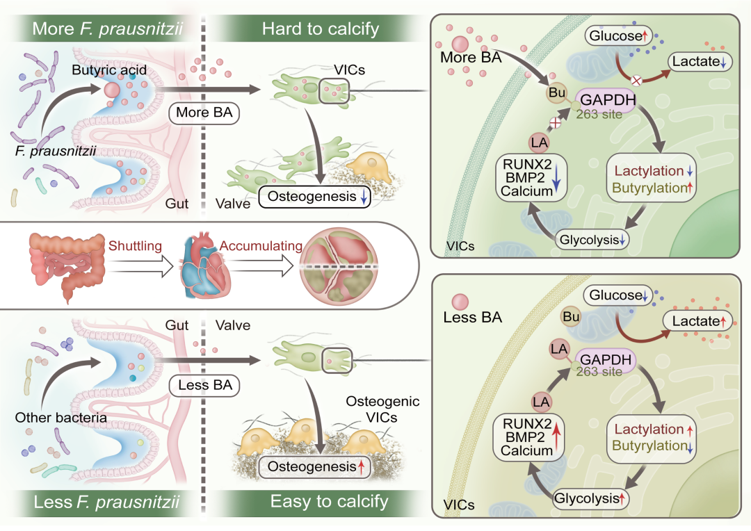 iMeta | 王春莉董念国王贵学许康解析肠道菌群影响脉瓣膜钙化的创新机制-CSDN博客
