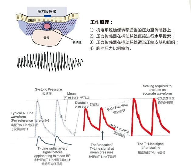 一文详解血压测量原理和方法_cnibp原理-CSDN博客