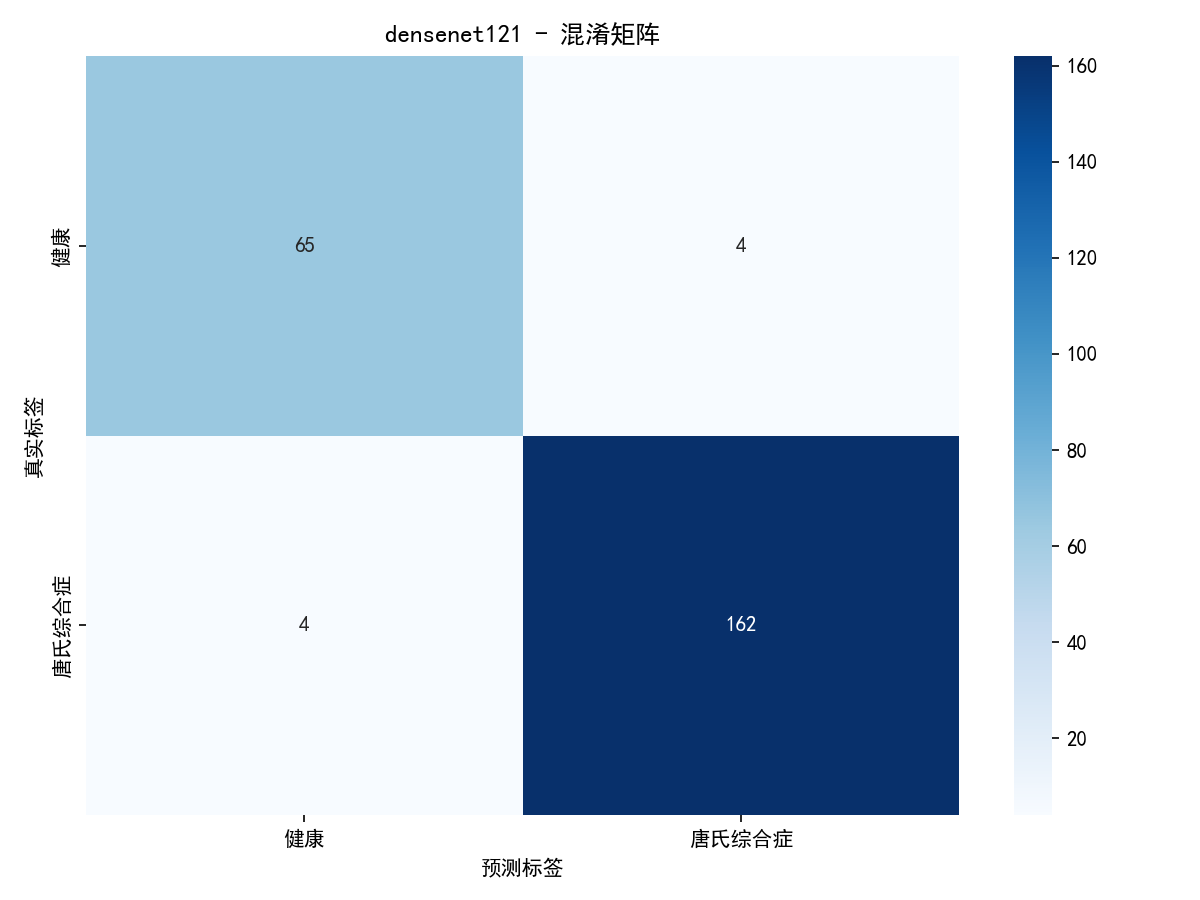 基于深度学习的唐氏综合症面部识别与智能诊断辅助系统-CSDN博客