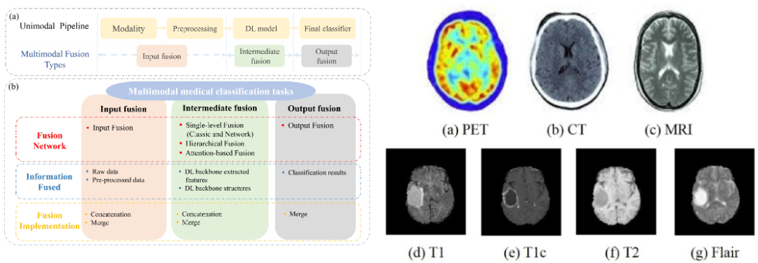 传统影像诊断OUT了！多模态医学影像融合彻底爆发！_a review of deep learning-based information ...
