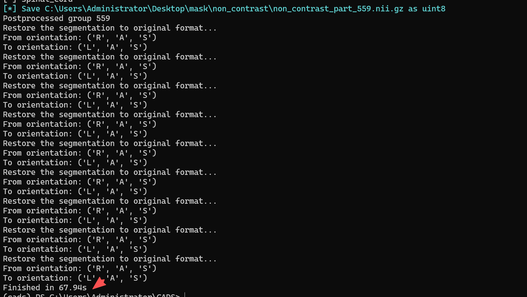 从这里可以看到，一个腹部CT的全身器官分割时间大概1分钟左右