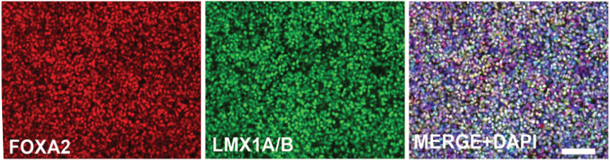 LN111上培养的hESC-DA的FOXA2和LMX1A/B的免疫荧光染色