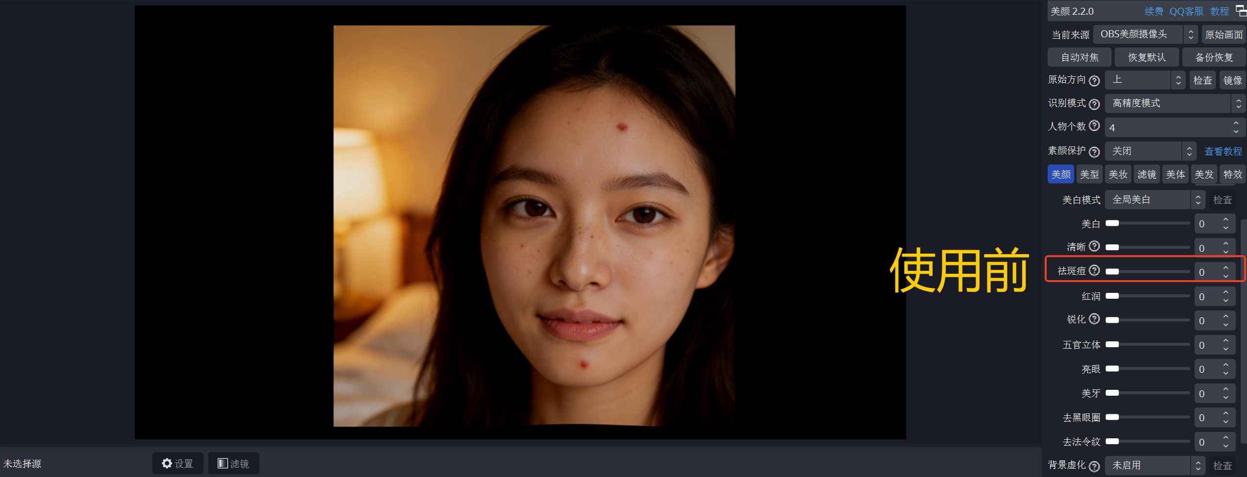 祛痘使用前.png