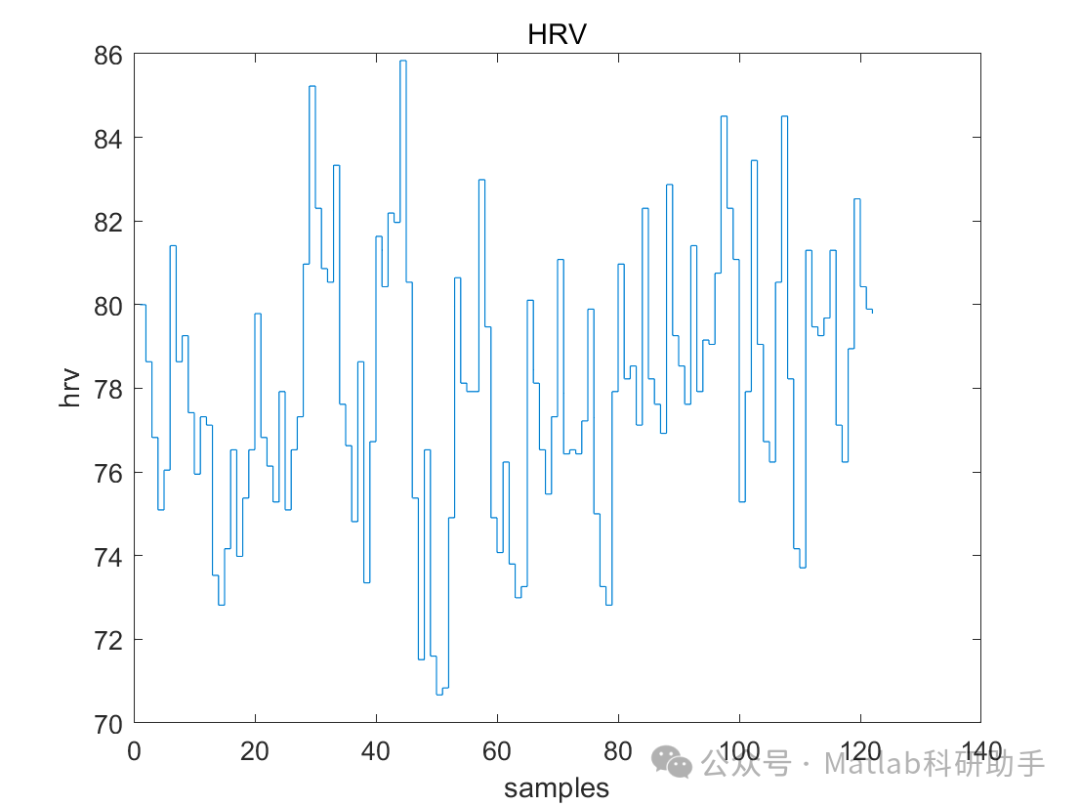 信号检测】PTT、HRV 和PRV 的ECG 和PPG 信号附Matlab代码_ppg信号-CSDN博客