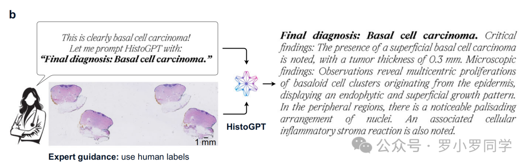 HistoGPT 在基底细胞癌病理报告生成中的应用